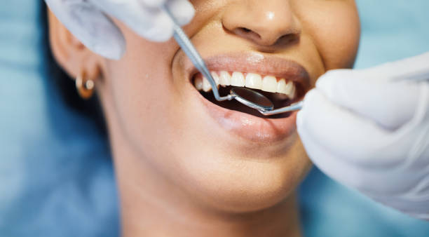 Best Emergency Root Canal Treatment in Liberty, MO